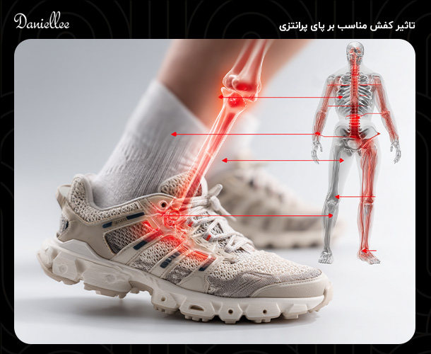کفش مناسب پای پرانتزی: راهنمای خرید و ویژگی های آن